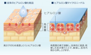 小じわが消えるwww